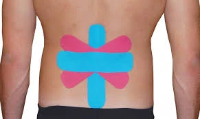 Kineziológiai tapaszok hátra